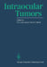 Intraocular Tumors: International Symposium Under the Auspices of the European Ophthalmological Society by P. K. Lommatzsch