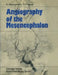 Angiography of the Mesencephalon: Normal and Pathological Findings by Auguste Wackenheim, Jean Paul Braun