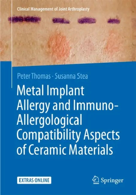 Metal Implant Allergy and Immuno-Allergological Compatibility Aspects of Ceramic Materials by Peter Thomas