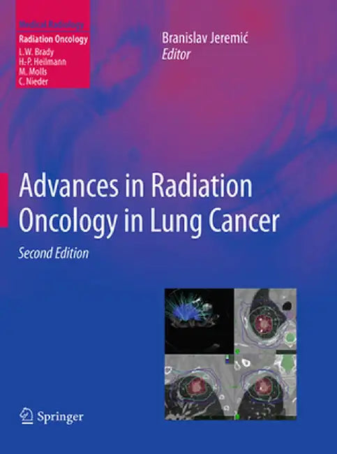 Advances in Radiation Oncology in Lung Cancer by Branislav Jeremic