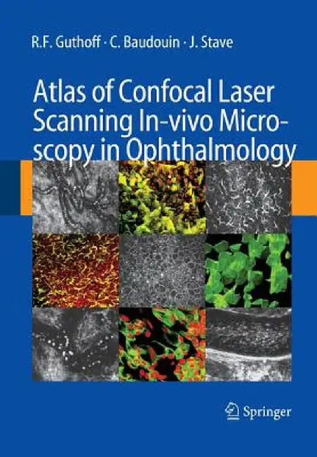 Atlas of Confocal Laser Scanning In-Vivo Microscopy in Ophthalmology: Principles and Applications in Diagnostic and Therapeutic Ophtalmology by R. F. Guthoff