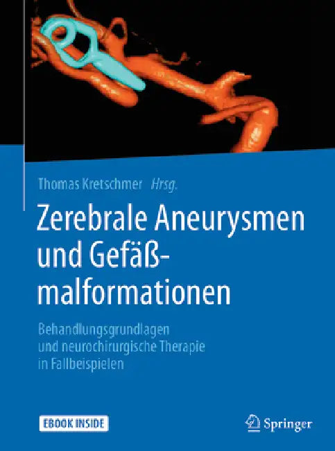 Zerebrale Aneurysmen Und Gefäßmalformationen: Behandlungsgrundlagen Und Neurochirurgische Therapie in Fallbeispielen by Thomas Kretschmer