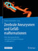 Zerebrale Aneurysmen Und Gefäßmalformationen: Behandlungsgrundlagen Und Neurochirurgische Therapie in Fallbeispielen by Thomas Kretschmer