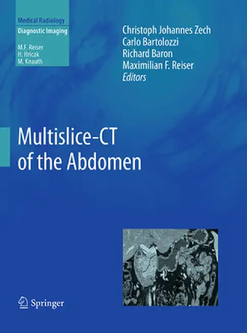 Multislice-CT of the Abdomen by Christoph Johannes Zech