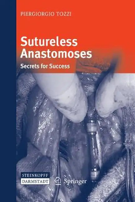 Sutureless Anastomoses: Secrets for Success by Piergiorgio Tozzi