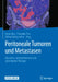 Peritoneale Tumoren Und Metastasen: Operative, Intraperitoneale Und Systemische Therapie by Beate Rau, Pompiliu Piso, Alfred Königsrainer