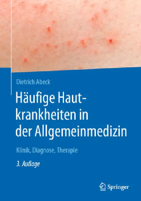 Häufige Hautkrankheiten in Der Allgemeinmedizin: Klinik, Diagnose, Therapie by Dietrich Abeck