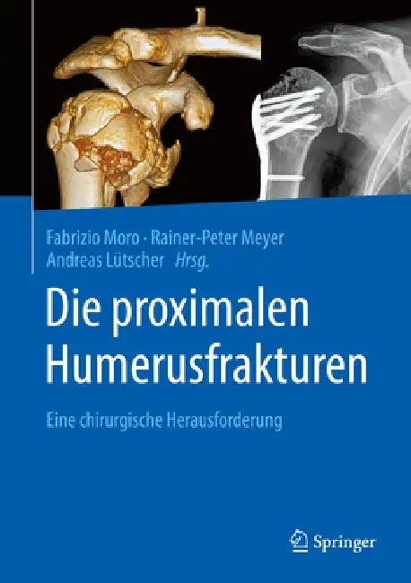 Die Proximalen Humerusfrakturen: Eine Chirurgische Herausforderung by Fabrizio Moro, Rainer-Peter Meyer, Andreas Lütscher