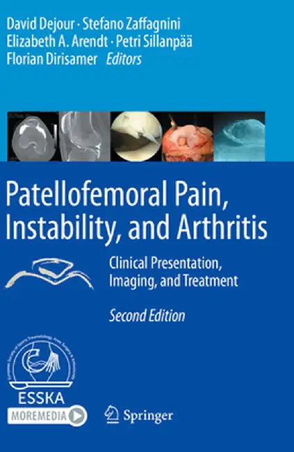 Patellofemoral Pain, Instability, and Arthritis: Clinical Presentation, Imaging, and Treatment by David Dejour
