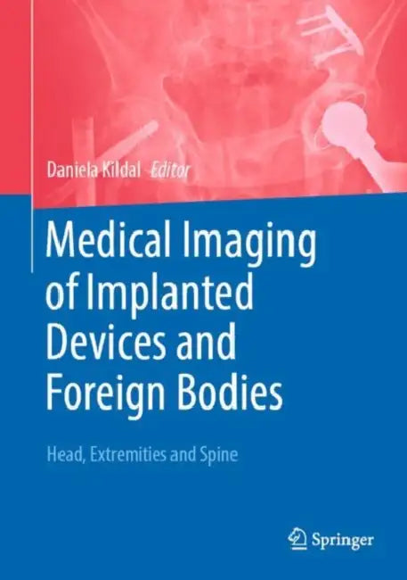 Medical Imaging of Implanted Devices and Foreign Bodies: Head, Extremities and Spine by Daniela Kildal