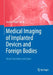 Medical Imaging of Implanted Devices and Foreign Bodies: Head, Extremities and Spine by Daniela Kildal