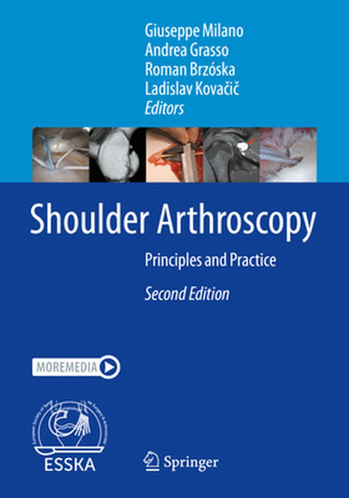 Shoulder Arthroscopy: Principles and Practice by Giuseppe Milano
