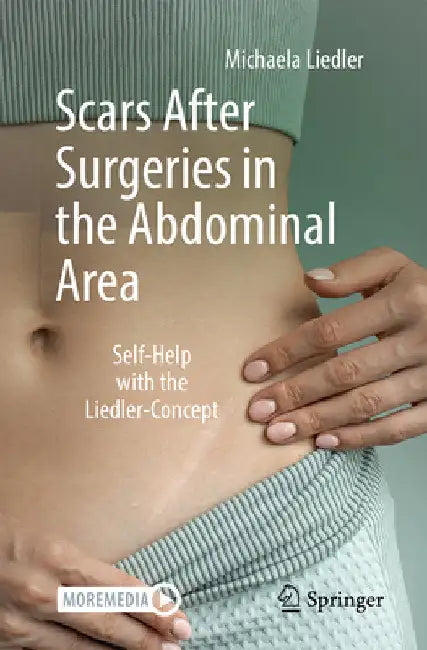 Scars After Surgeries in the Abdominal Area: Self-Help with the Liedler-Concept by Liedler, Michaela