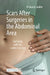 Scars After Surgeries in the Abdominal Area: Self-Help with the Liedler-Concept by Liedler, Michaela