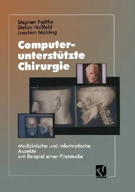Computerunterstützte Chirurgie: Medizinische Und Informatische Aspekte Am Beispiel Einer Pilotstudie by Stephen Fedtke
