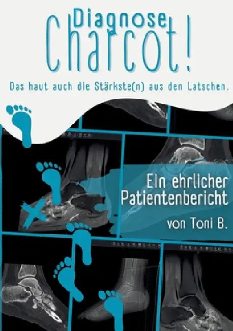 Diagnose Charcot!: Das haut auch die Stärkste(n) aus den Latschen. by Toni B