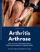 Arthritis - Arthrose. Ohne Prothesen und lebensbedrohliche Medikamente schmerzfrei und gesund werden. Der neue Weg bei Gelenkerkrankungen: Was hilft k by André Schudel