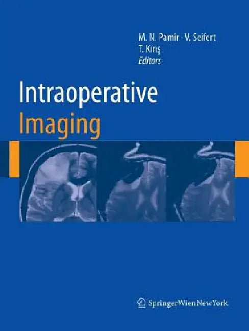 Intraoperative Imaging by M. Necmettin Pamir, Volker Seifert, Talat Kiris