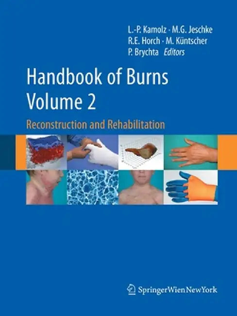 Handbook of Burns, Volume 2: Reconstruction and Rehabilitation by Lars-Peter Kamolz