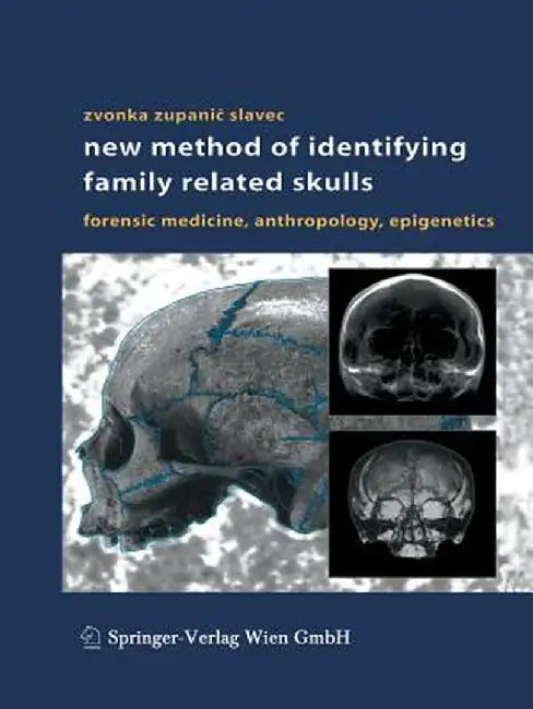 New Method of Identifying Family Related Skulls: Forensic Medicine, Anthropology, Epigenetics by Zvonka Zupanic Slavec