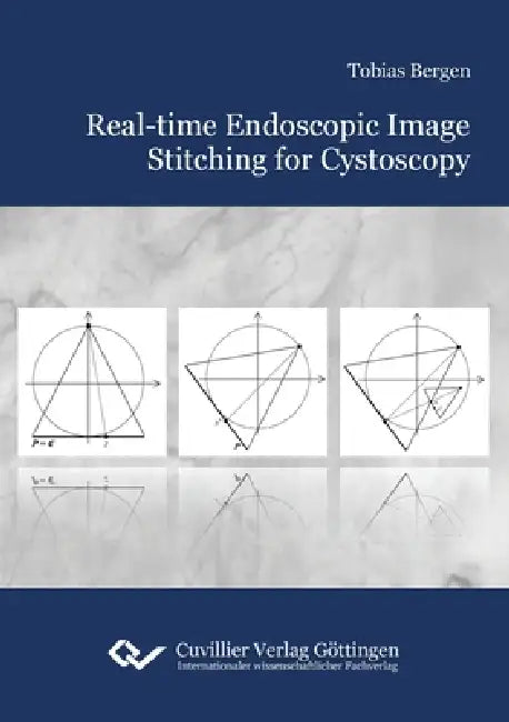 Real-time Endoscopic Image Stitching for Cystoscopy by Tobias Bergen