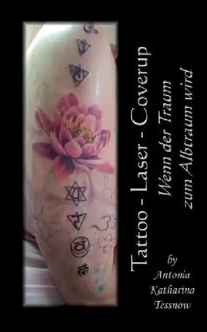 Tattoo - Laser - Cover Up: Wenn der Traum zum Albtraum wird by Tessnow, Antonia Katharina