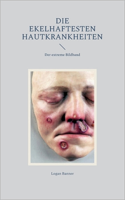 Die ekelhaftesten Hautkrankheiten: Der extreme Bildband by Logan Banner