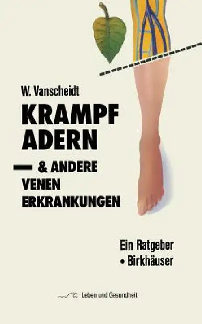 Krampfadern Und Andere Venenerkrankungen: Ein Ratgeber by W. Vanscheidt