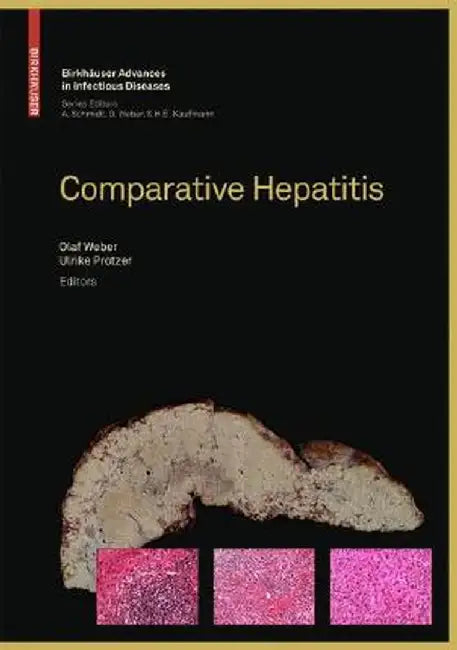 Comparative Hepatitis by Olaf Weber, Ulrike Protzer