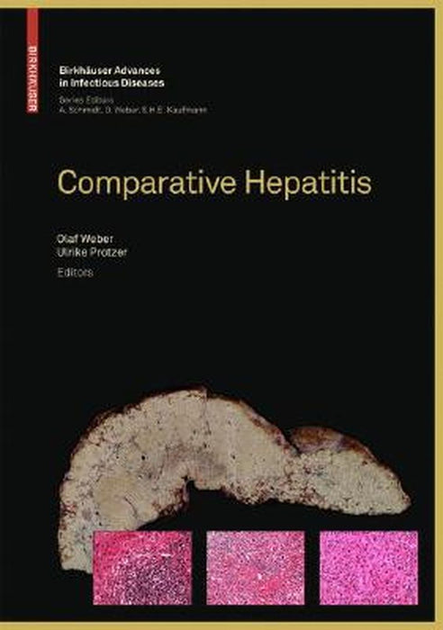 Comparative Hepatitis by Olaf Weber, Ulrike Protzer