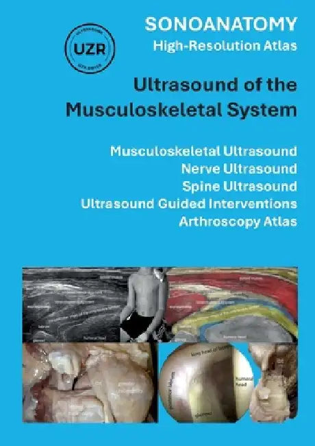Sonoanatomy - High-Resolution Atlas - Ultrasound of the Musculoskeletal System: Musculoskeletal Ultrasound, Nerve Ultrasound, Spine Ultrasound, Ultras by Giorgio Tamborrini