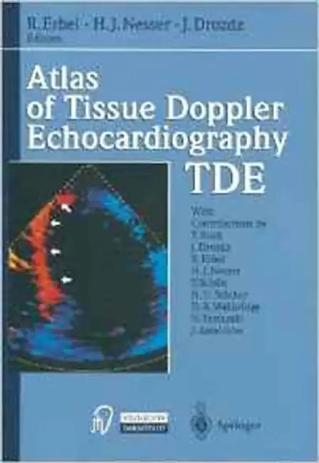 Atlas Of Tissue Doppler Echocardiography - Tde by R. Erbel, H.J. Nesser, J. Drozdz