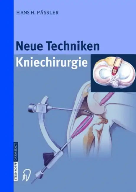 Neue Techniken - Kniechirurgie by H. H. Pdssler, H. H. P??ssler, H. H. Passler