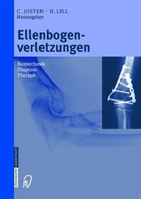 Ellenbogenverletzungen: Biomechanik - Diagnose - Therapie by C. Josten, H. Lill