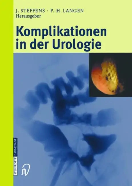 Komplikationen in Der Urologie by Joachim Steffens, Paul-Heinz Langen
