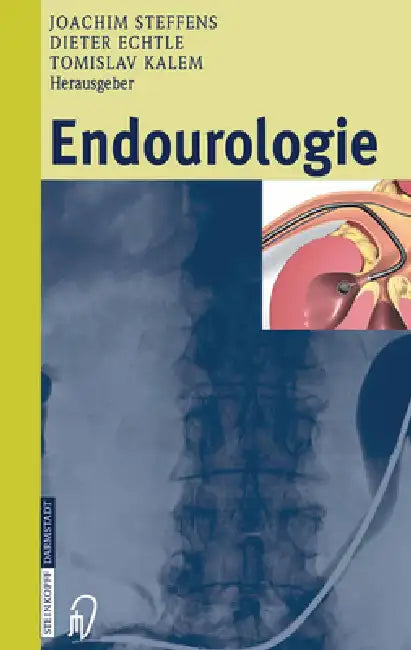Endourologie by Joachim Steffens, Dieter Echtle, Tomislav Kalem