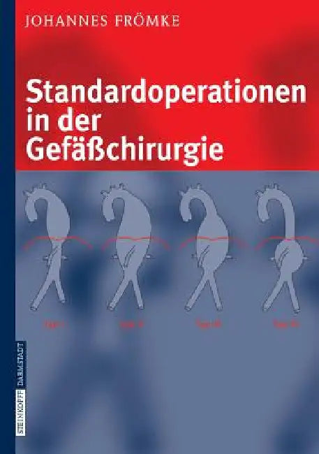 Standardoperationen in Der Gefäßchirurgie by Johannes Frömke