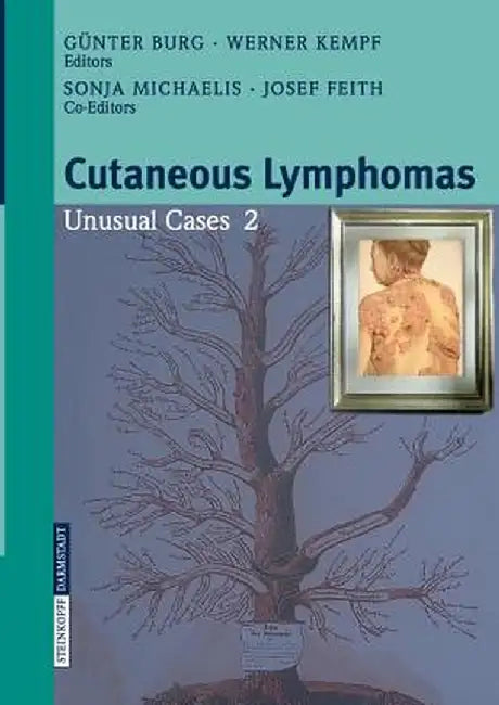 Cutaneous Lymphomas: Unusual Cases 2 by S. Michaelis