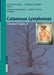 Cutaneous Lymphomas: Unusual Cases 2 by S. Michaelis