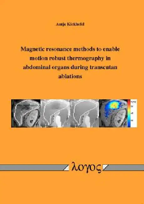 Magnetic Resonance Methods to Enable Motion Robust Thermography in Abdominal Organs During Transcutan Ablations by Antje Kickhefel