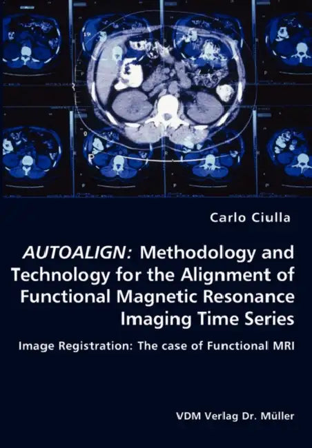 Autoalign: Methodology and Technology for the Alignment of Functional Magnetic Resonance Imaging Time Series by Carlo Ciulla