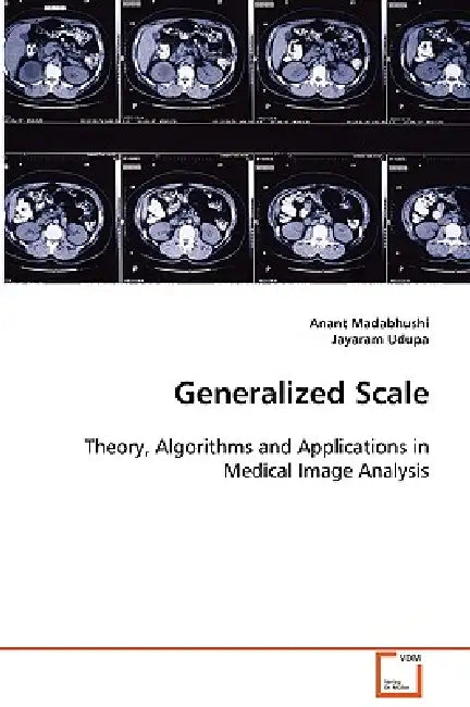 Generalized Scale by Anant Madabhushi, Jayaram Udupa