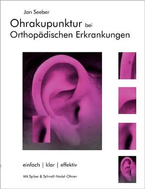 Ohrakupunktur bei Orthopädischen Erkrankungen: Balancierte Ohrakupunktur: einfach, klar, effektiv by Seeber, Jan