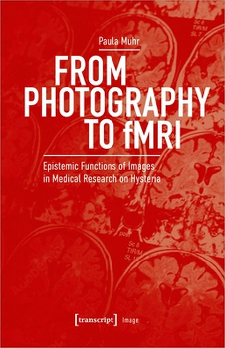 From Photography to Fmri: Epistemic Functions of Images in Medical Research on Hysteria