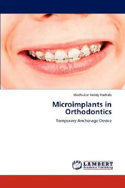 Microimplants in Orthodontics by Madhukar Reddy Rachala