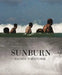 Sunburn by Daniel Tchetchik