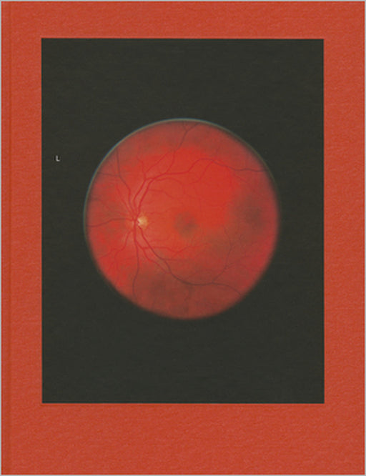 Michael Subotzky: Retinal Shift by Mikhael Subotzky