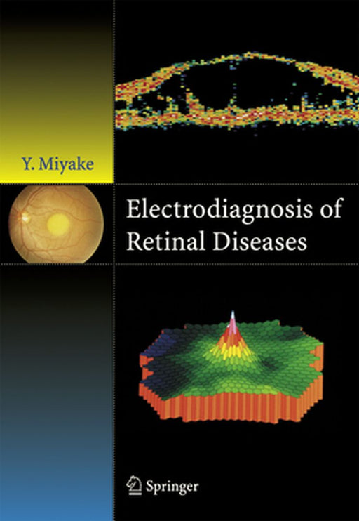 Electrodiagnosis of Retinal Disease by Yozo Miyake
