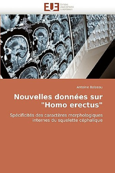 Nouvelles Données Sur "homo Erectus" by Balzeau-A