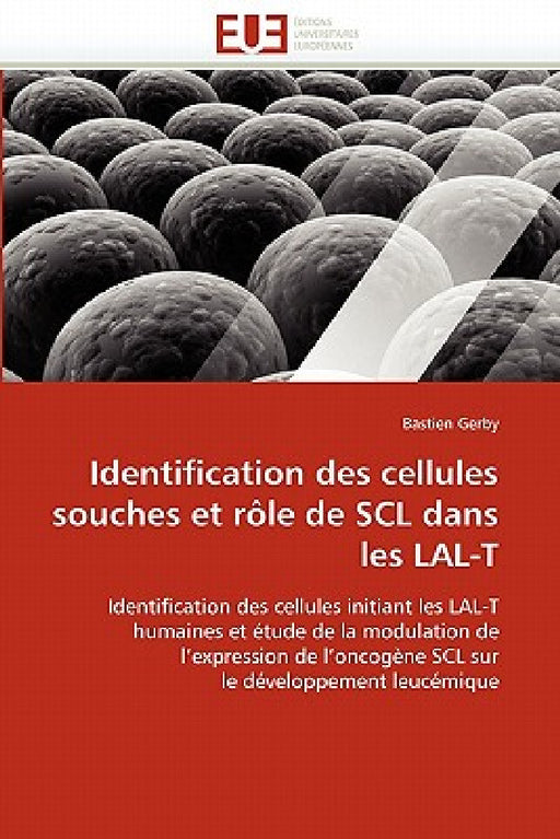 Identification Des Cellules Souches Et Rôle de Scl Dans Les Lal-T by Gerby-B